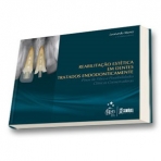 Reabilitação Estética Dentes Tratados Endodonticamente - Pinos de Fibra Possibilidades Clínicas Conservadoras - 1ª/2010