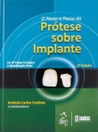 O Passo-a-Passo da Prótese Sobre Implantes - Da 2ª Etapa Cirúrgica à Reabilitação Final - 2ª/2012