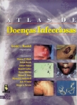 ATLAS DE DOENCAS INFECCIOSAS