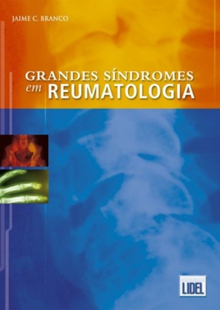 GRANDES SINDROMES EM REUMATOLOGIA