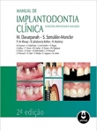 MANUAL DE IMPLANTODONTIA CLINICA 2ED.