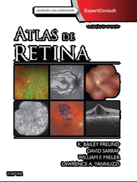 ATLAS DE RETINA 2/18