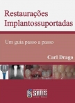 Restaurações Implantossuportadas - Um Guia passo a passo - 1ª/2008