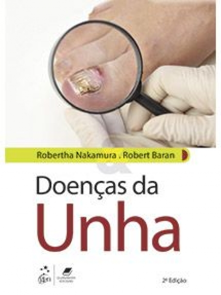 DOENÇAS DA UNHA 2/18