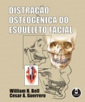 DISTRACAO OSTEOGENICA DO ESQUELETO FACIAL