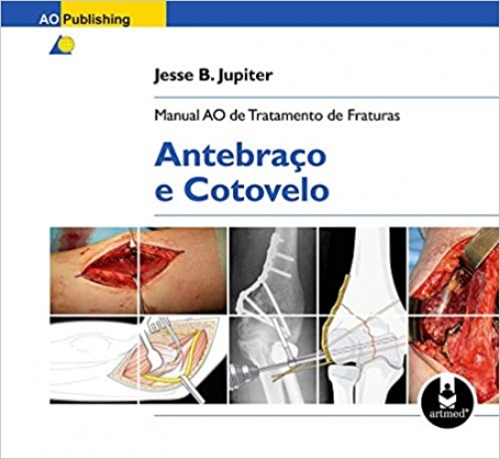 MANUAL AO DE TRATAMENTO DE FRATURAS