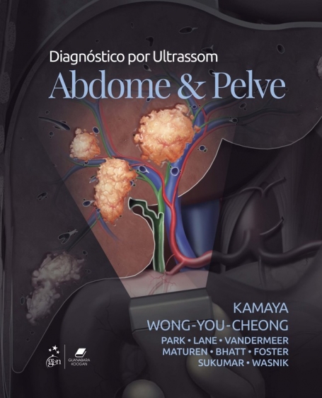 DIAGNOSTICO POR ULTRASSOM ABDOME E PELVE