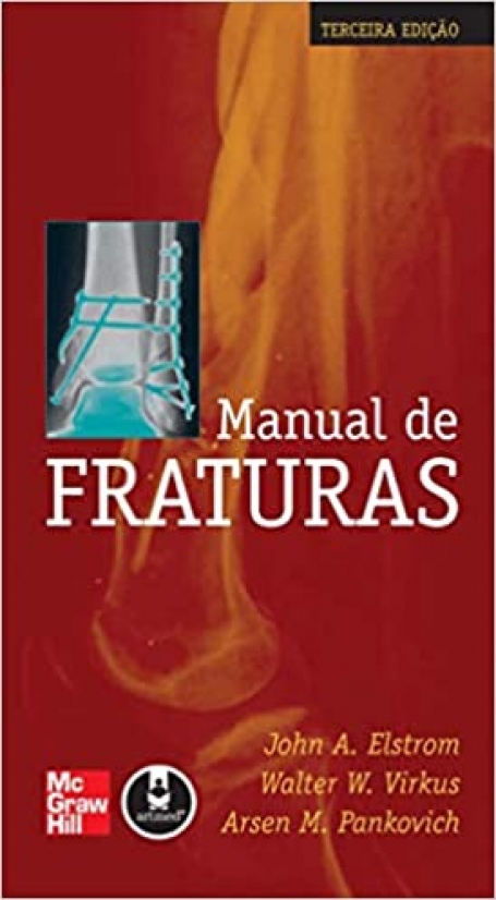MANUAL DE FRATURAS - 3.º EDICAO