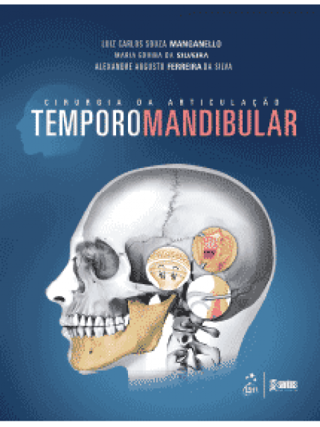 Cirurgia da Articulação Temporomandibular - 1ª/2014