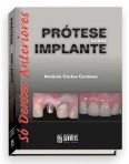 Prótese Sobre Implante - Só Dentes Anteriores - 1ª/2008