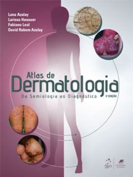 AZULAY. L.-ATLAS DE DERMATOLOGIA 3/20