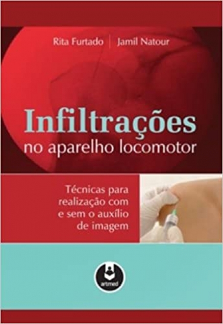 INFILTRAÇOES DO APARELHO LOCUMOTOR Técnicas para Realização com e sem o Auxílio de Imagem