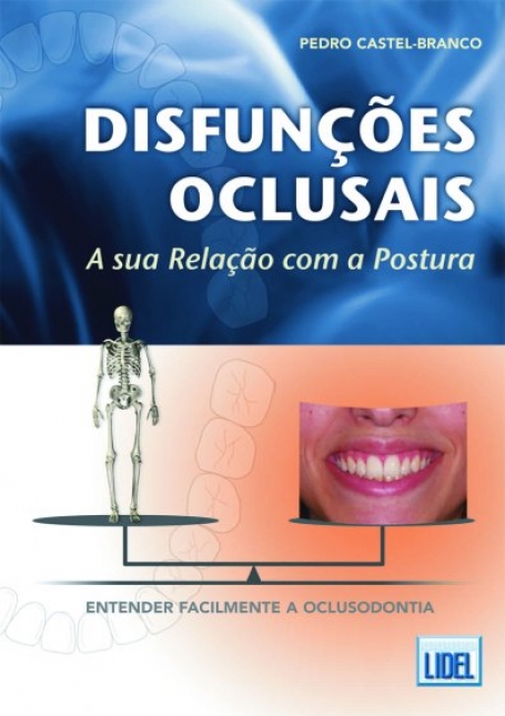 DISFUNCOES OCLUSAIS - SUA RELACAO COM A POSTURA