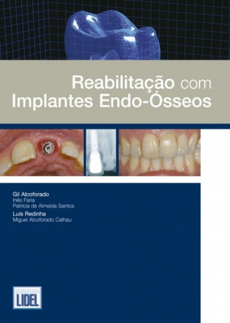 REABILITAÇÃO COM IMPLANTES ENDO-ÓSSEOS