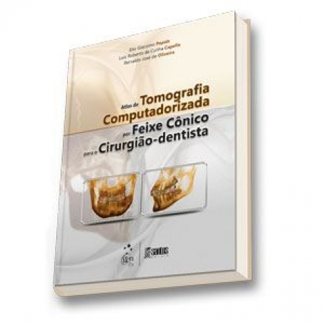 Atlas de Tomografia Computadorizada por Feixe Cônico para o Cirurgião-Dentista - 1ª/2011