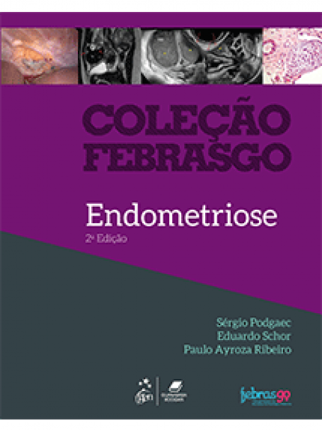 COLECAO FEBRASGO - ENDOMETRIOSE 2/20