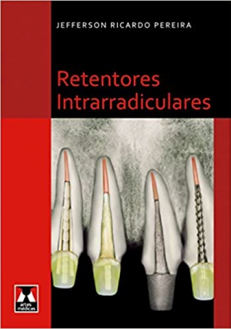 RETENTORES INTRARRADICULARES