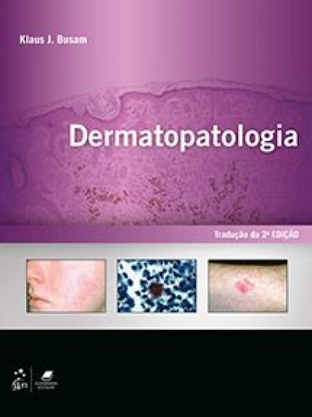 BUSAM-DERMATOPATOLOGIA 2/19