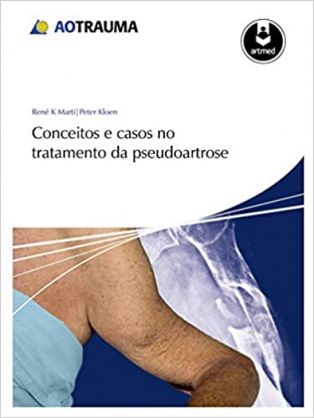 CONCEITOS E CASOS NO TRATAMENTO DA PSEUDOARTROSE