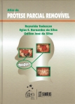 ATLAS DE PROTESE PARCIAL REMOVIVEL