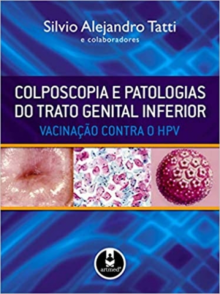 COLPOSCOPIA E PATOLOGIAS DO TRATO GENITAL INFERIOR