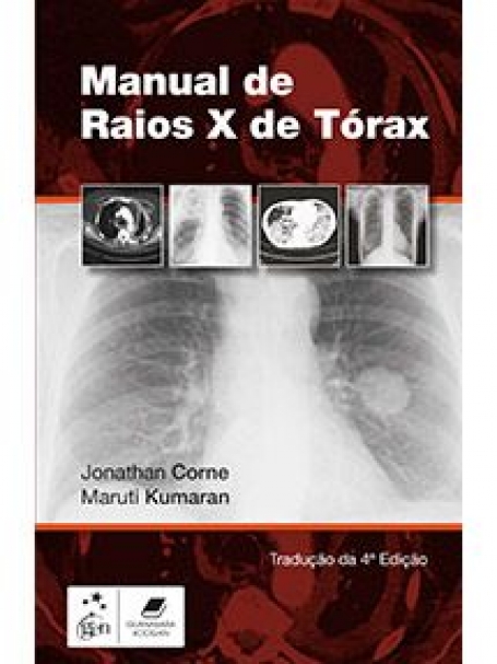 CORNE-MANUAL DE RAIOS-X DE TÓRAX 4/16