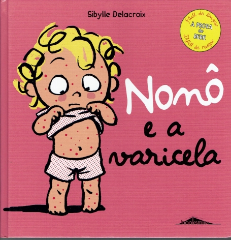 NONO E A VARICELA