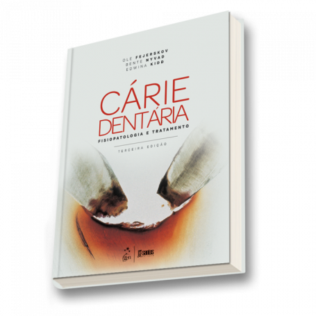 Cárie Dentária: Fisiopatologia e Tratamento