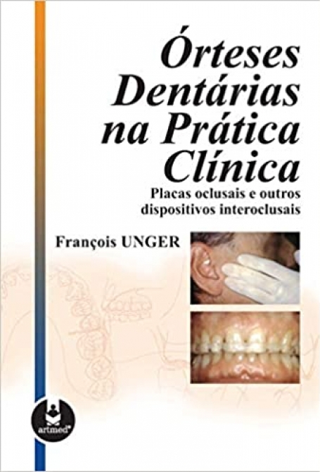 ORTESES DENTARIAS NA PRATICA CLINICA