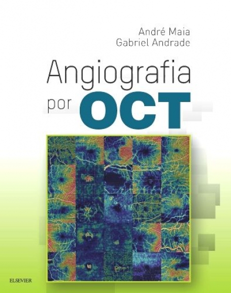 ANGIOGRAFIA POR OCT 1/18
