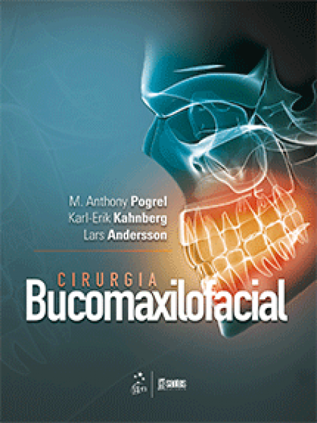 Cirurgia Bucomaxilofacial - 1ª/2016