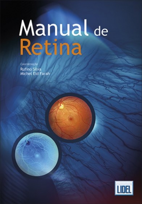 MANUAL DE RETINA