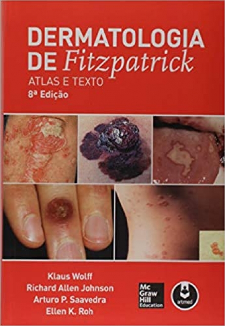 DERMATOLOGIA DE FITZPATRICK : ATLAS E TEXTO 8ª EDIÇAO