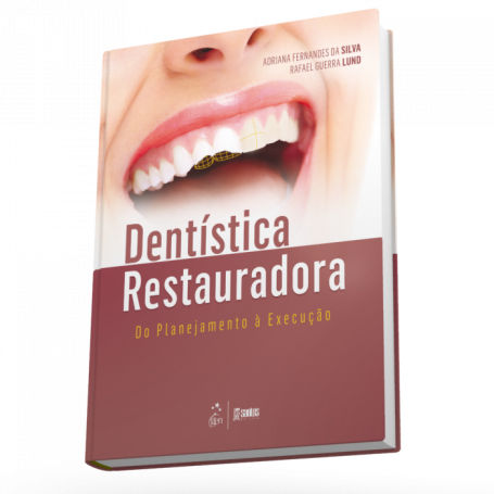 Dentística Restauradora - Do Planejamento à Execução - 1ª/2016