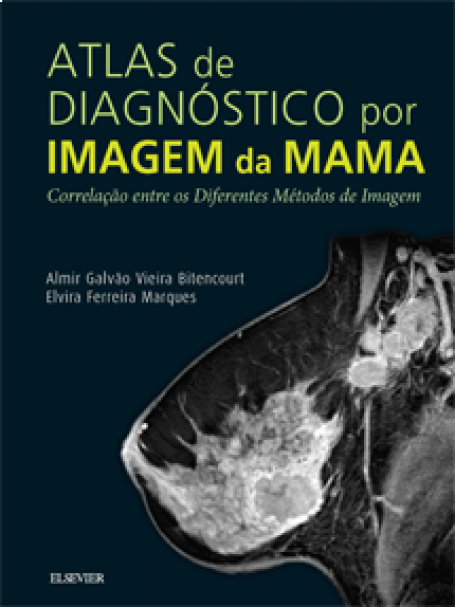 ATLAS DE DIAGNÓSTICO POR IMAGEM DE MAMA 1/18