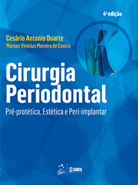 Cirurgia Periodontal - Pré-protética, Estética e Peri-implantar - 4ª/2015