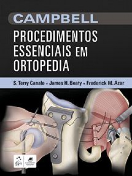 CAMPBELL PROCEDIMENTOS ESSENCIAIS EM ORTOPEDIA 1/17