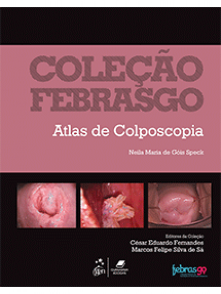 COLECAO FEBRASGO - ATLAS DE COLPOSCOPIA