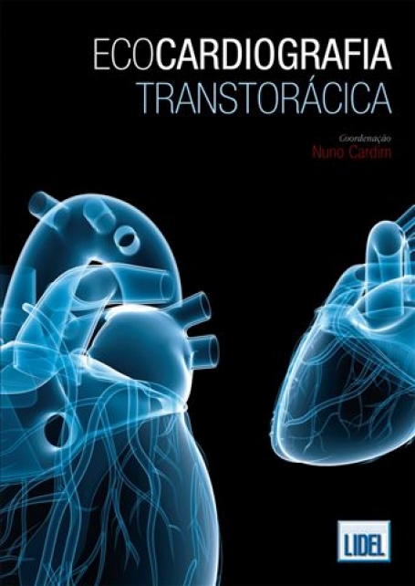 ECOCARDIOGRAFIA TRANSTORACICA