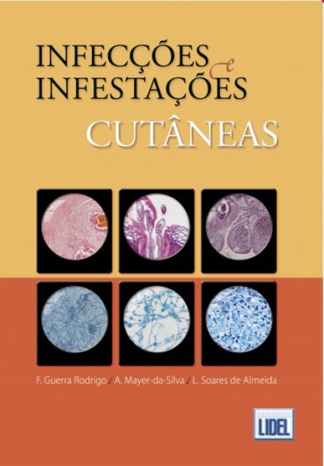 INFECCOES & INFESTACOES CUTANEAS