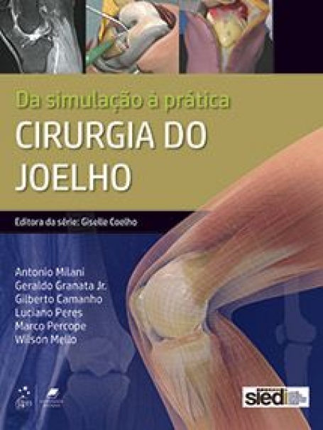 CIRURGIA DO JOELHO 1/19