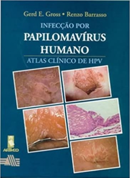 INFECCAO POR PAPILOMAVIRUS HUMANO