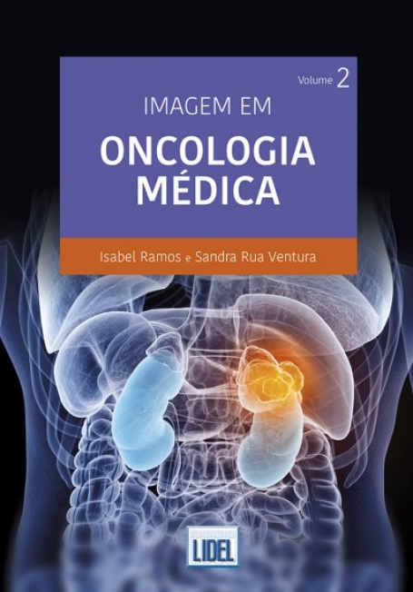 IMAGEM EM ONCOLOGIA MEDICA VOL. 2