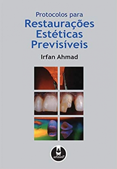 PROTOCOLOS PARA RESTAURACOES ESTETICAS PREVISIVEIS