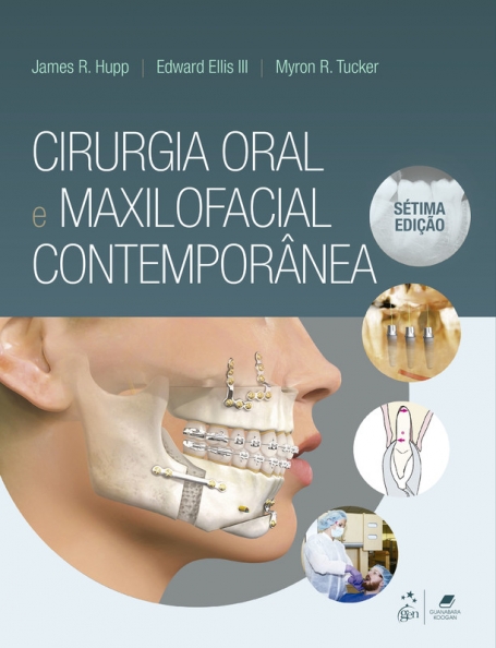 CIRUGIA ORAL E MAXILOFACIAL CONTEMPORANEA 7 EDIÇAO