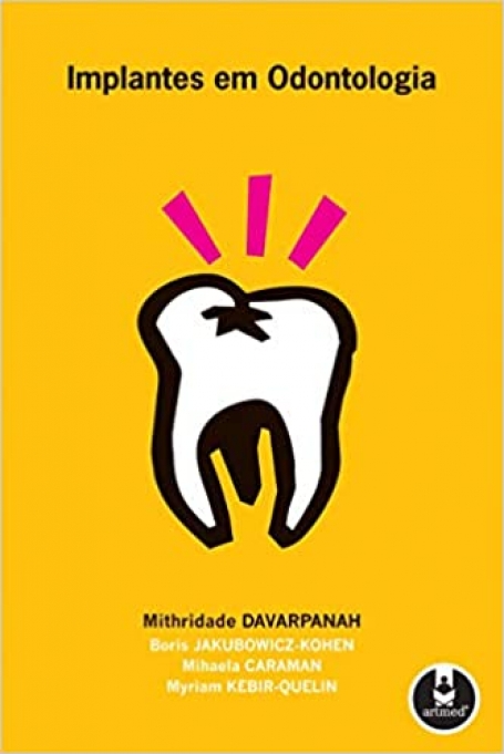 IMPLANTES EM ODONTOLOGIA
