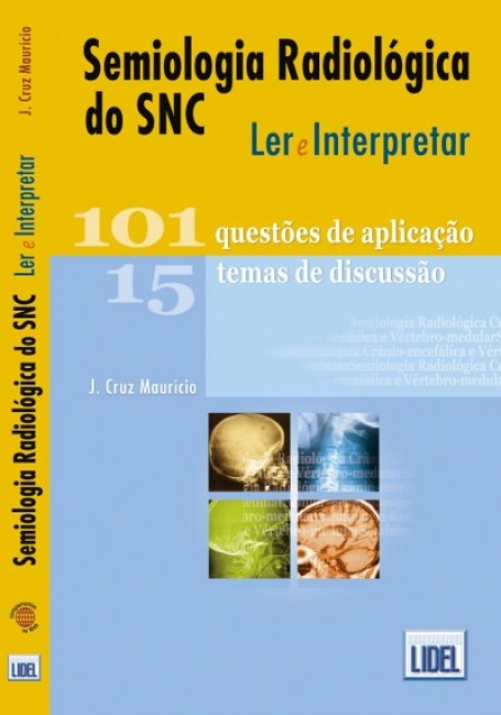 SEMIOLOGIA RADIOLOGICA DO SNC LER E INTERPRETAR 101 QUESTOES DE APLICACAO 15 TEMAS DE DISCURSSAO