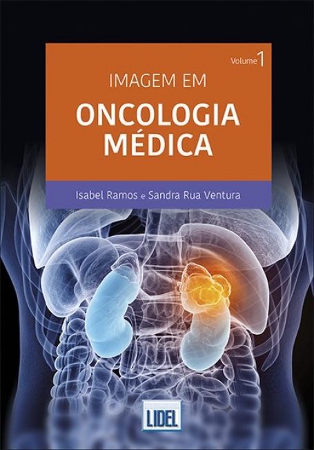 IMAGEM EM ONCOLOGIA MEDICA volume 1