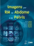 Imagens por Ressonância Magnética do Abdome e Pelvis - 1ª/2013