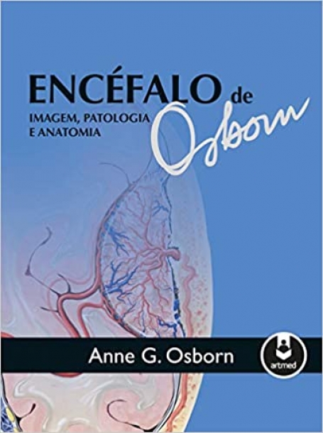 ENCEFALO DE OSBORN: IMAGEM, PATOLOGIA E ANATOMIA